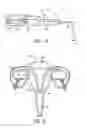 Fig. 08 - Uterine electrical stimulation system and method