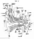 Fig. 02 - Implantable device migration control
