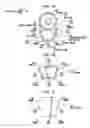 Fig. 03 - Implantable device migration control