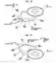 Fig. 05 - Implantable device migration control