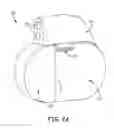Fig. 04 - Implantable medical device construction