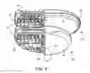 Fig. 07 - Implantable medical device construction