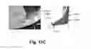 Fig. 09 - Methods of and devices for chemical and threshold-gated electrical neuro-immuno-stimulation that triggers the stem cell growth to restore bodily functions
