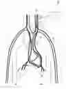 Fig. 01 - METHOD AND DEVICE FOR RESPIRATORY AND CARDIORESPIRATORY SUPPORT