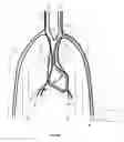 Fig. 04 - METHOD AND DEVICE FOR RESPIRATORY AND CARDIORESPIRATORY SUPPORT