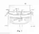 Fig. 07 - HIP PAD WITH THERMOFORMED LAYER