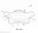 Fig. 02 - MUSCLE EXERCISE DEVICE