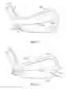 Fig. 02 - Progressive iron set