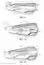 Fig. 08 - Progressive iron set
