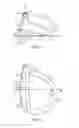 Fig. 02 - Golf club head with flexure