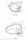 Fig. 04 - Golf club head with flexure