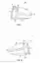 Fig. 05 - Golf club head with flexure