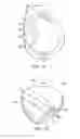 Fig. 09 - Golf club head with flexure