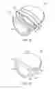 Fig. 12 - Golf club head with flexure