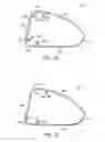 Fig. 13 - Golf club head with flexure