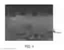 Fig. 02 - SKINLESS POLYETHERSULFONE MEMBRANE