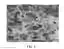 Fig. 03 - SKINLESS POLYETHERSULFONE MEMBRANE