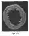 Fig. 14 - Zeolite-containing catalyst and method for producing the same, and method for producing propylene