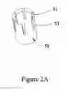 Fig. 04 - Sprinkler head nozzle assembly with adjustable arc, flow rate and stream angle