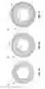 Fig. 04 - Systems and methods for fabricating spiral coils with atomized bioactive coatings