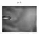 Fig. 05 - Electrostatic coating method and gun for electrostatic coating