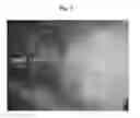 Fig. 07 - Electrostatic coating method and gun for electrostatic coating