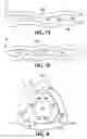 Fig. 09 - Material sorting discs with variable interfacial opening