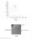 Fig. 02 - METHOD FOR ASSEMBLING, BY BRAZING, A SUBSTRATE COMPRISING PYROCARBON WITH PARTS COMPRISING PYROCARBON