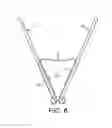 Fig. 07 - Binder clip