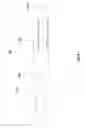 Fig. 02 - Fingertip mountable writing instrument