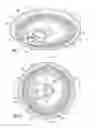 Fig. 02 - Can end with strengthening bead configuration