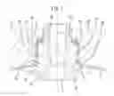 Fig. 06 - Mouthpiece structure for pressure vessel