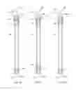 Fig. 09 - Water purification system with active vibration