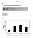 Fig. 76 - Compositions containing HC-HA/PTX3 complexes and methods of use thereof