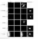 Fig. 08 - Anti-HSV antibody