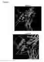 Fig. 09 - Immunoglobulins and variants directed against pathogenic microbes