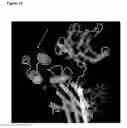 Fig. 22 - Immunoglobulins and variants directed against pathogenic microbes