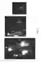 Fig. 05 - Compositions and Methods for the Removal of Biofilms