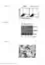 Fig. 15 - Methods and Compositions for Treating or Diagnosing Melanoma