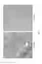 Fig. 09 - Compositions and methods for treating fatty tissue buildup