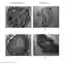 Fig. 01 - METHOD FOR PRODUCING FUNCTIONAL FUSION TISSUE