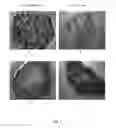 Fig. 02 - METHOD FOR PRODUCING FUNCTIONAL FUSION TISSUE