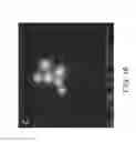 Fig. 23 - SINGLE MOLECULE NUCLEIC ACID NANOPARTICLES