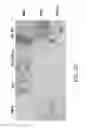 Fig. 32 - SINGLE MOLECULE NUCLEIC ACID NANOPARTICLES