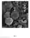 Fig. 02 - METHOD FOR CHITOSAN PRODUCTION