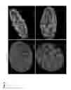 Fig. 06 - Methods for evaluating Alzheimer's disease and disease severity