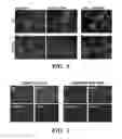 Fig. 06 - Compositions and methods for multiplex biomarker profiling