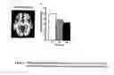 Fig. 07 - METHOD FOR IDENTIFYING INCREASED RISK OF ANXIETY DISORDERS