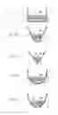 Fig. 33 - Continuous, semicontinuous and batch methods for treating liquids and manufacturing certain constituents (e.g.,nanoparticles) in liquids, apparatuses and nanoparticles and nanoparticle/liquid solution(s) and colloids resulting therefrom