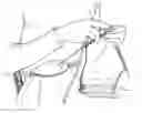 Fig. 01 - Contoured needle support device